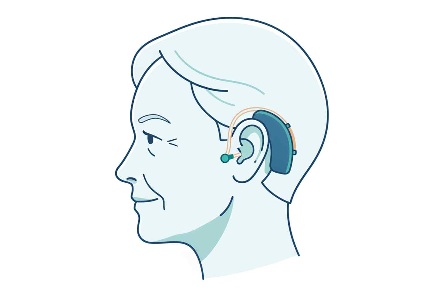 Senior adult wearing a behind-the-ear hearing aid medical illustration