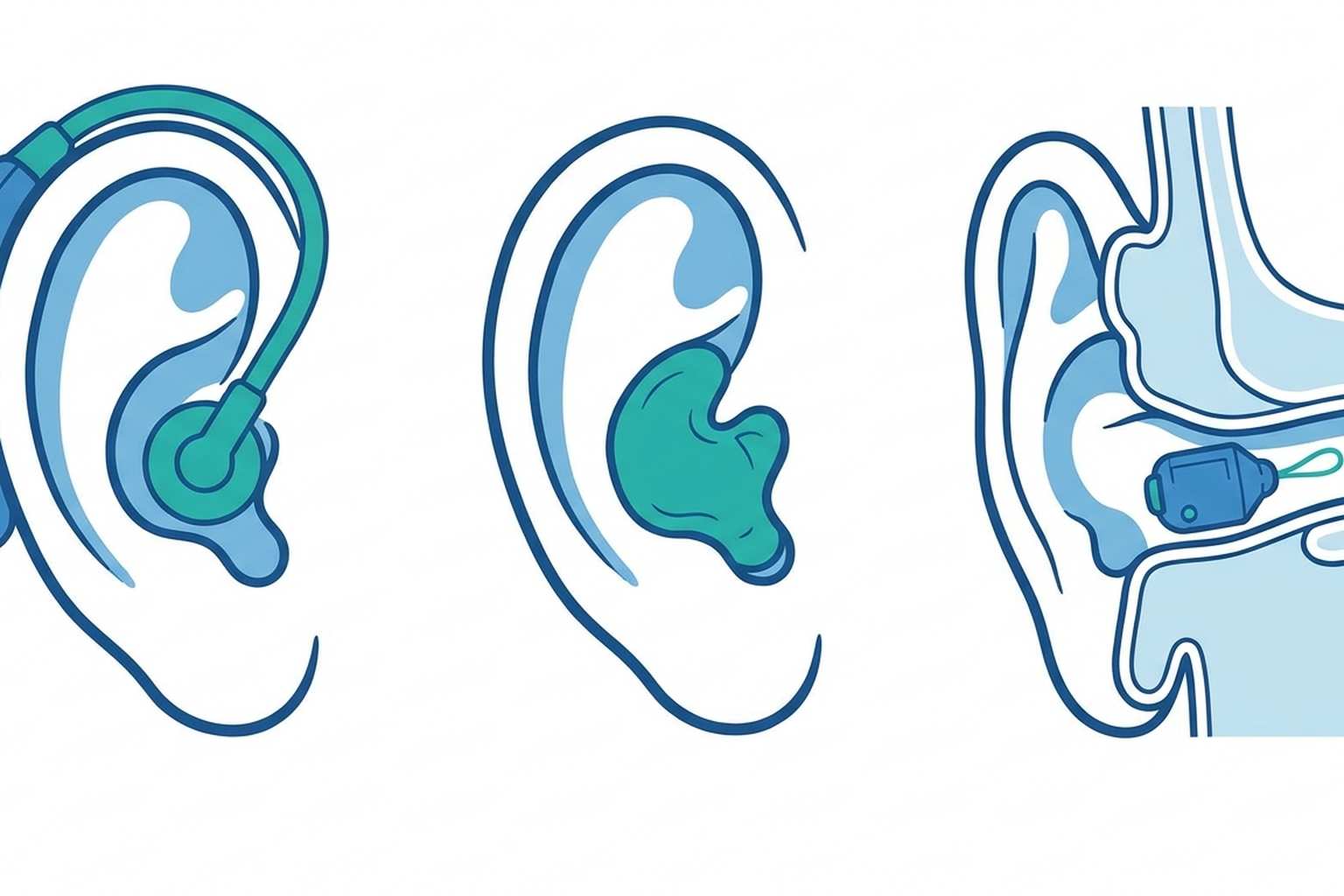 Different types of OTC hearing aids compared