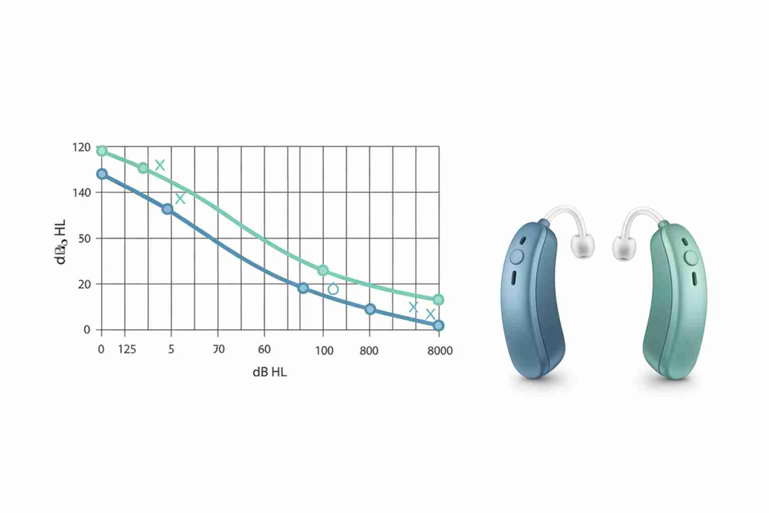 Medical illustration of an audiogram showing hearing loss patterns for both ears with hearing aids