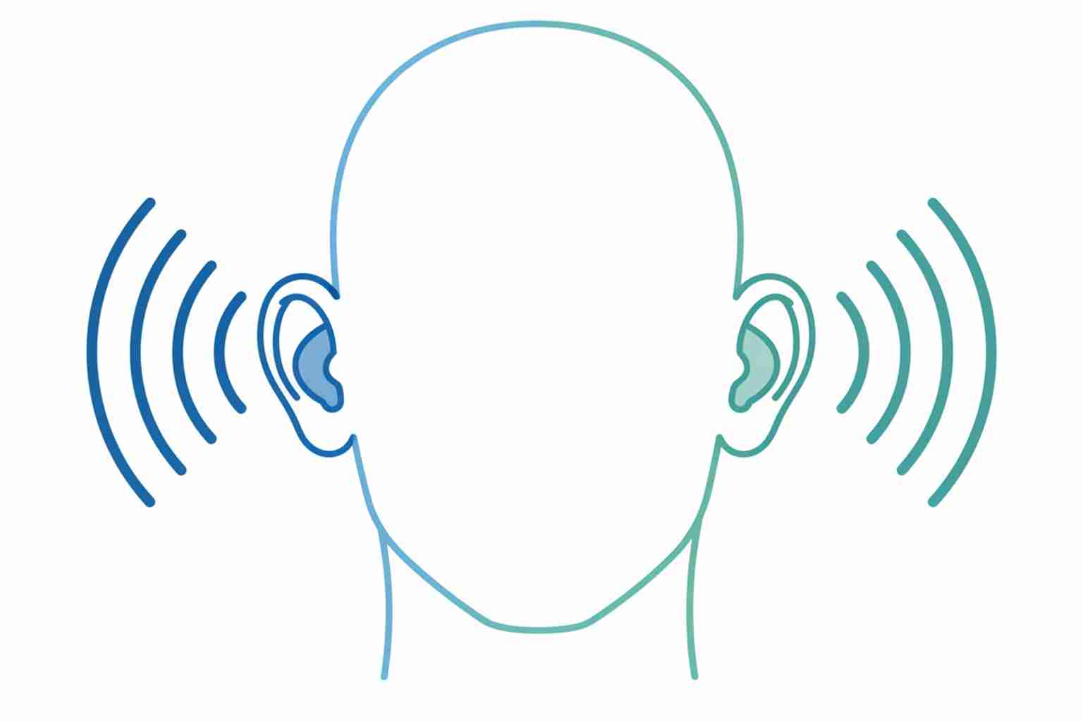 Medical illustration of bilateral hearing loss showing both ears receiving sound waves in blue and teal