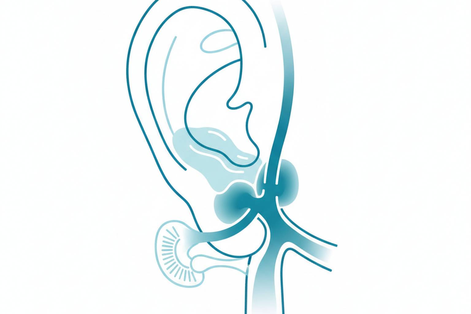 Eustachian tube blockage causing middle ear fluid