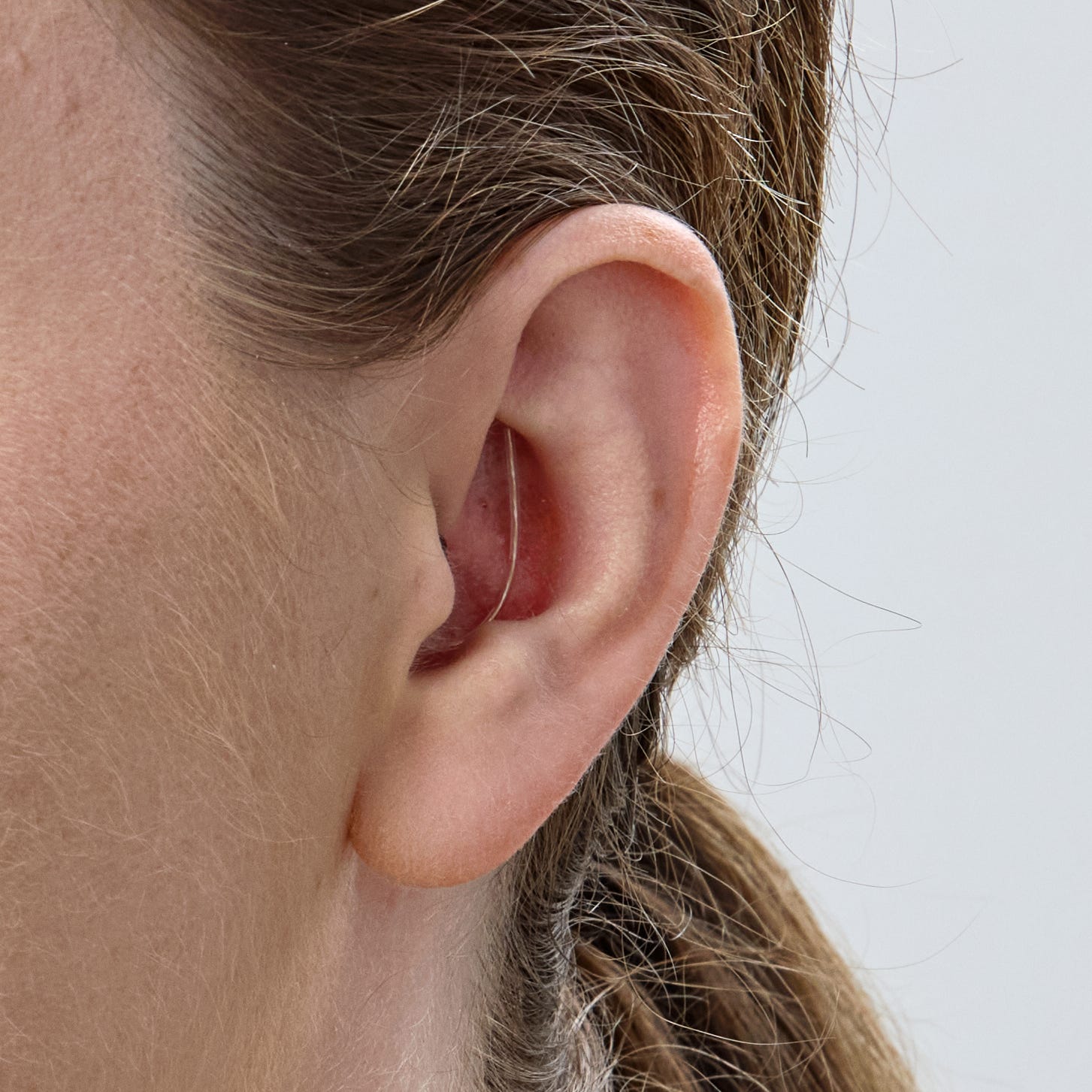 Oticon Zeal NXT hearing aid worn discreetly in the ear