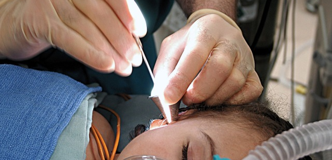 ear procedure, doctor